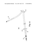 Systems and Methods for Implanting Medical Devices diagram and image