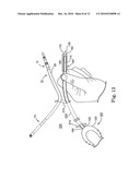 Systems and Methods for Implanting Medical Devices diagram and image