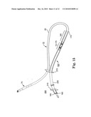 Systems and Methods for Implanting Medical Devices diagram and image