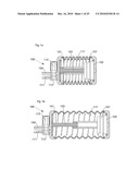 DRAINAGE DEVICE COMPRISING AN ACTIVE FILTER diagram and image