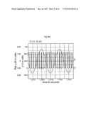 DRAINAGE DEVICE COMPRISING AN ACTIVE FILTER diagram and image