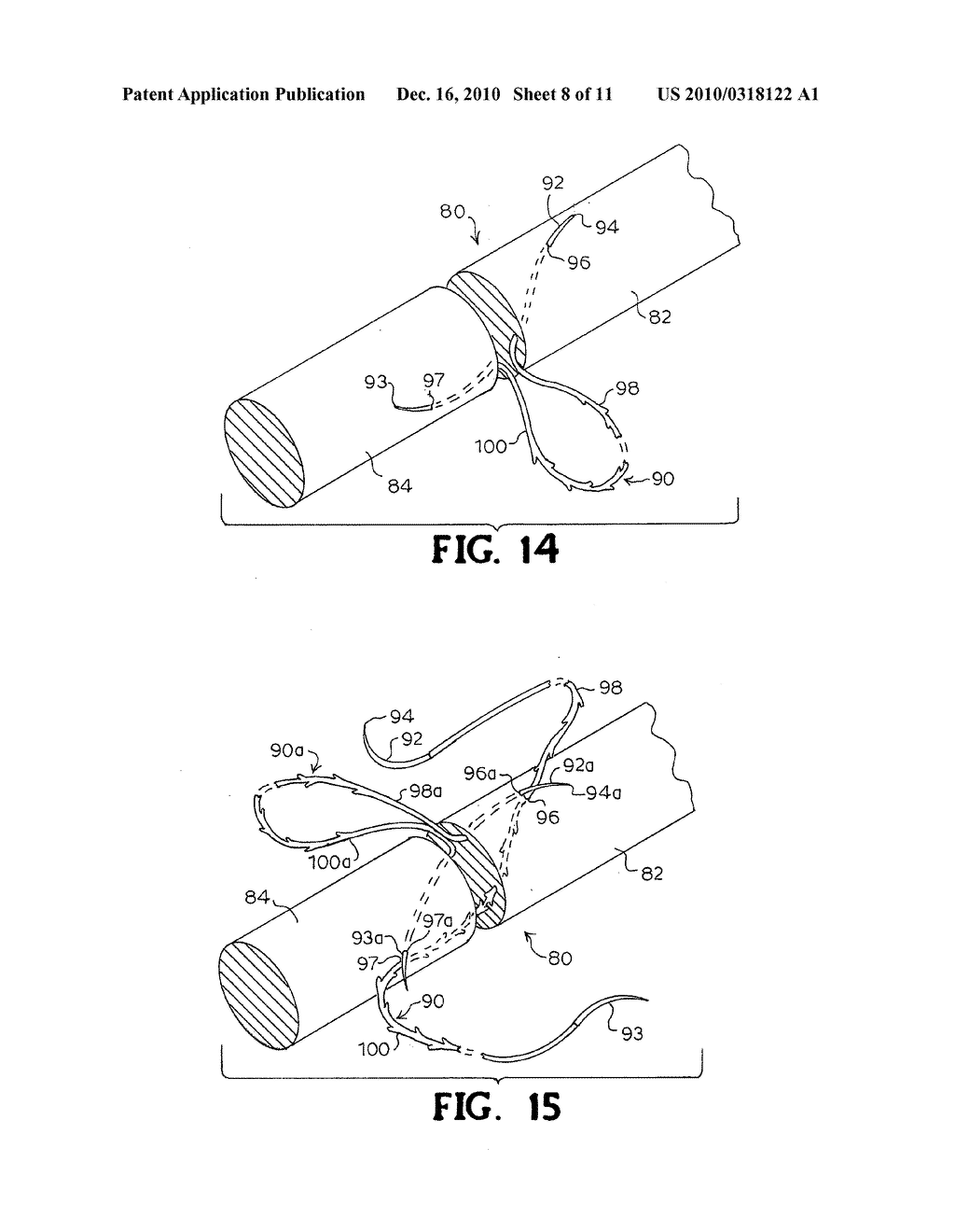 MULTIPLE SUTURE THREAD CONFIGURATION WITH AN INTERMEDIATE CONNECTOR - diagram, schematic, and image 09