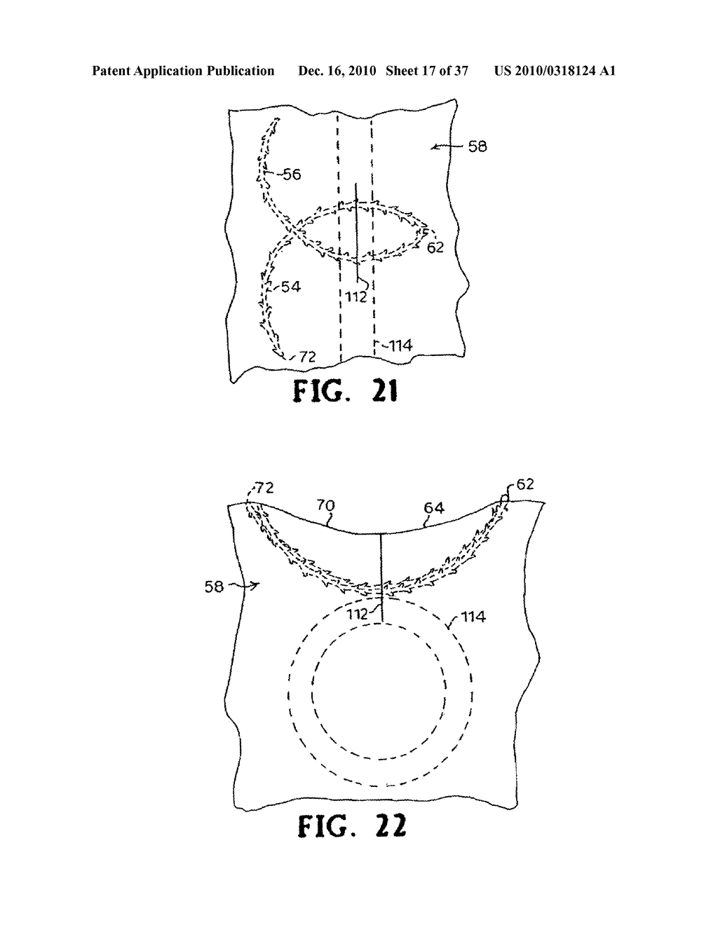 SUBCUTANEOUS SINUSOIDAL WOUND CLOSURE UTILIZING ONE-WAY SUTURE - diagram, schematic, and image 18