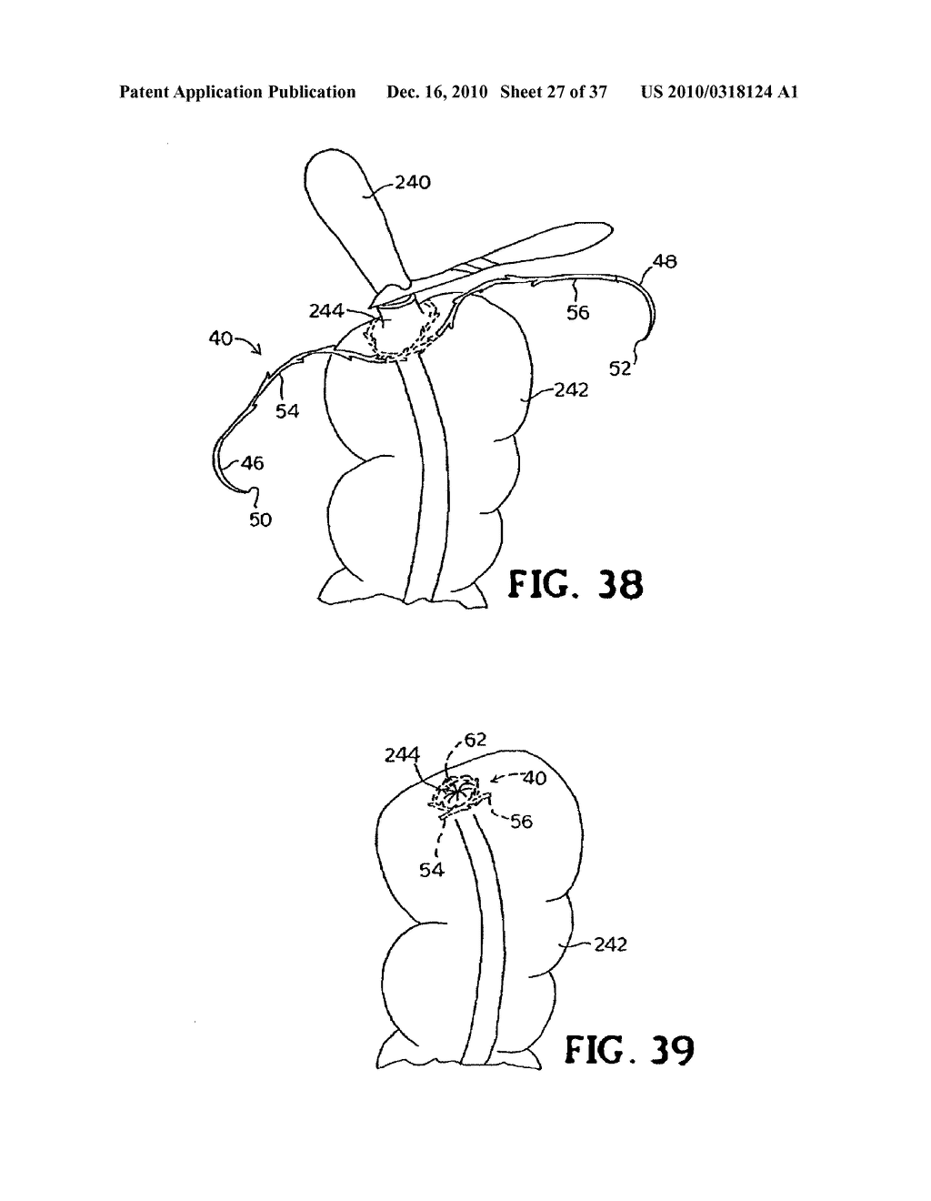 SUBCUTANEOUS SINUSOIDAL WOUND CLOSURE UTILIZING ONE-WAY SUTURE - diagram, schematic, and image 28