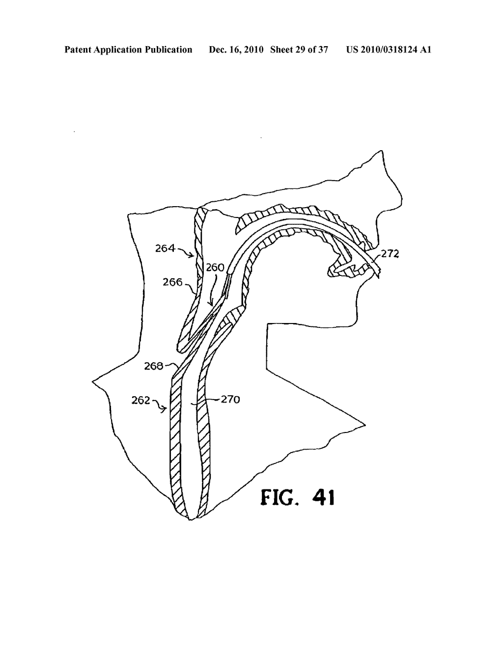 SUBCUTANEOUS SINUSOIDAL WOUND CLOSURE UTILIZING ONE-WAY SUTURE - diagram, schematic, and image 30