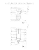 Anchor Device For Knot-Free Attachment Of Tissue To A Bone diagram and image