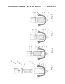 Anchor Device For Knot-Free Attachment Of Tissue To A Bone diagram and image