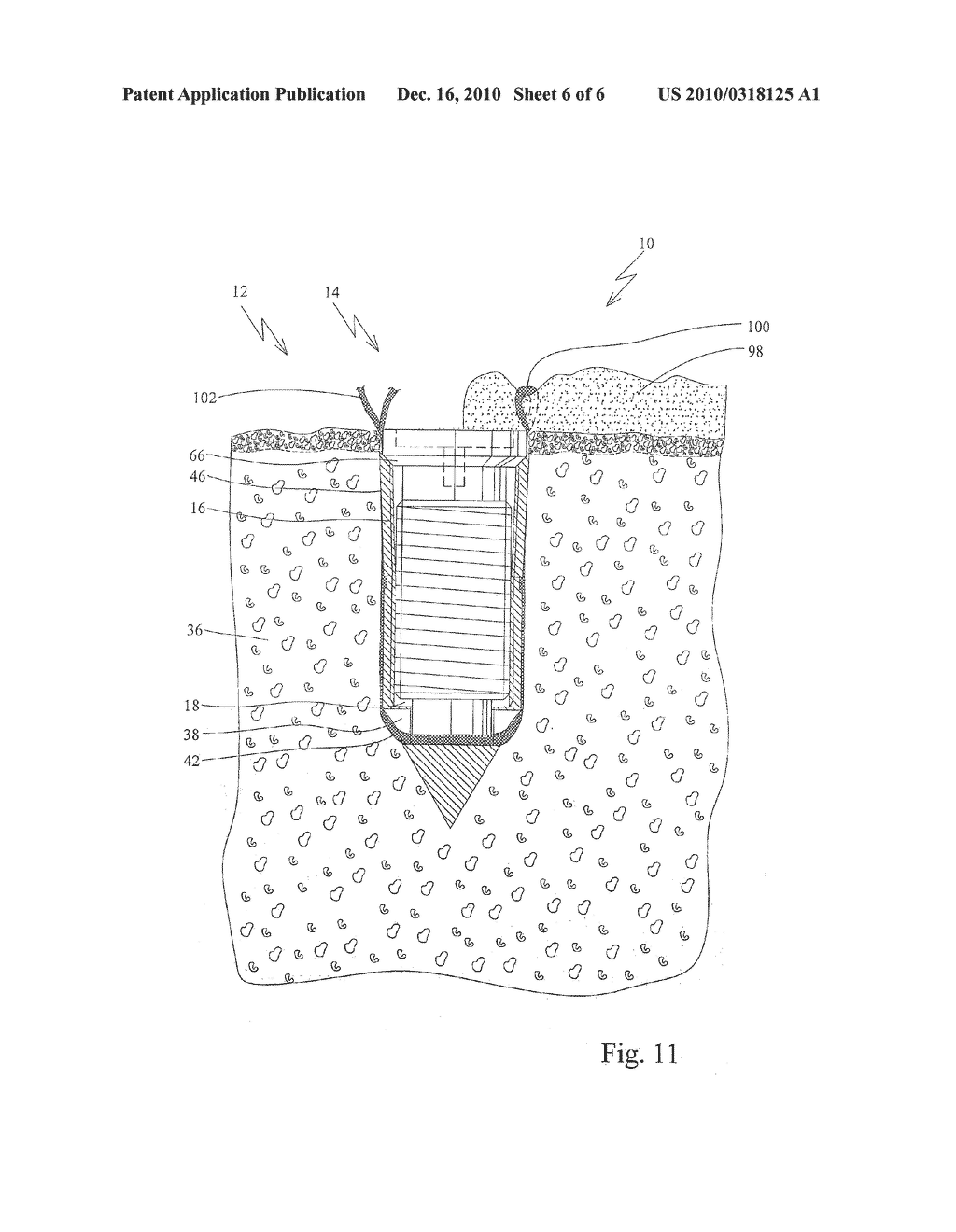 Anchor Device For Knot-Free Attachment Of Tissue To A Bone - diagram, schematic, and image 07