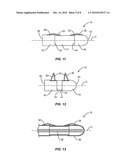 INTERSPINOUS IMPLANT AND METHODS OF USE diagram and image