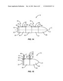 INTERSPINOUS IMPLANT AND METHODS OF USE diagram and image