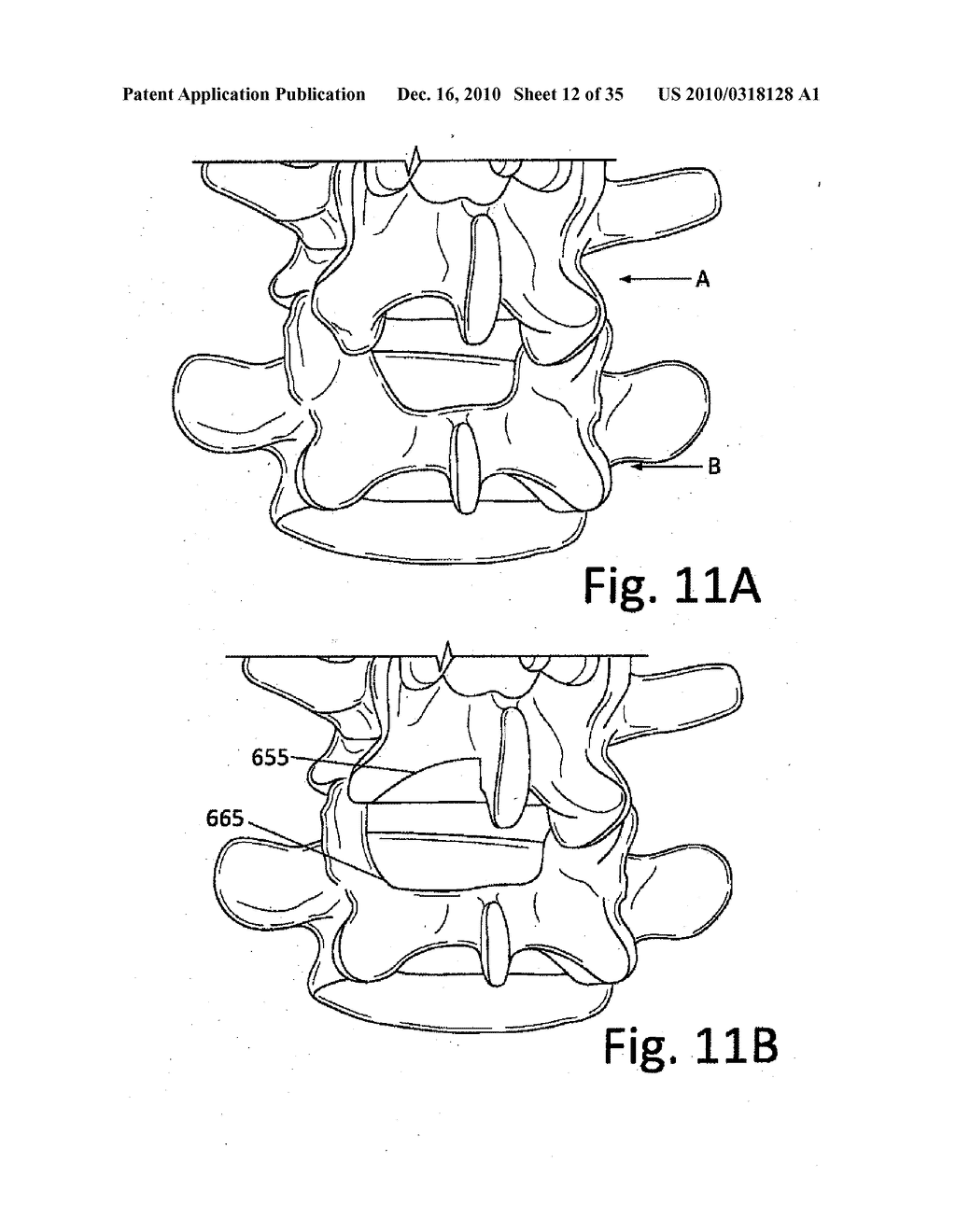 DEVICES AND METHODS FOR INTER-VERTEBRAL ORTHOPEDIC DEVICE PLACEMENT - diagram, schematic, and image 13