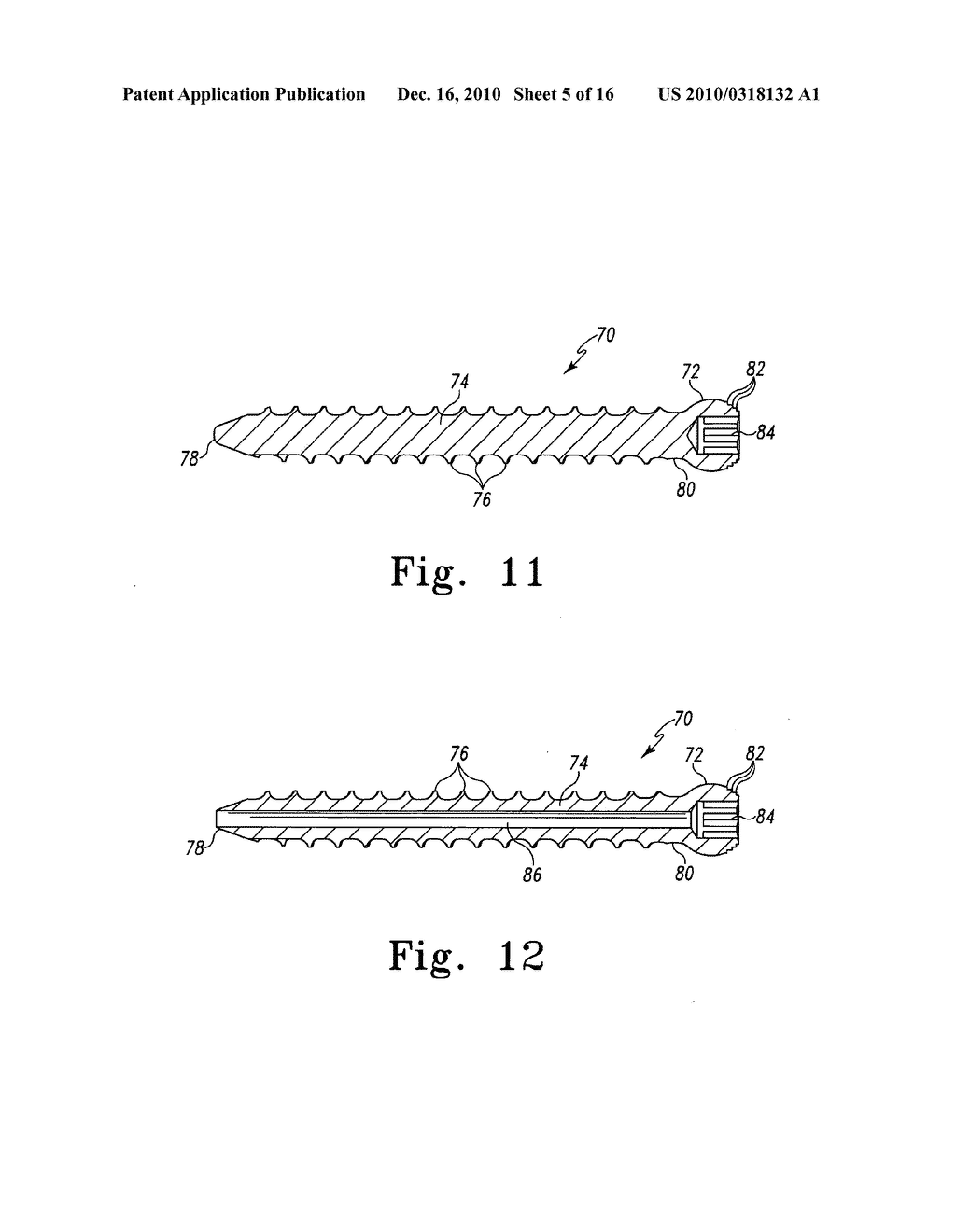 Spinal Implants and Methods With Extended Multi-Axial Anchor Assemblies - diagram, schematic, and image 06