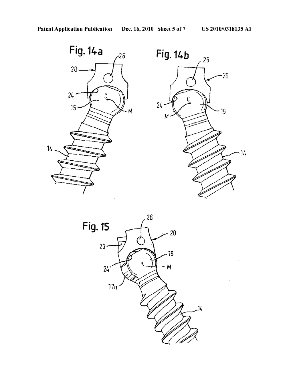 BONE ANCHORING DEVICE - diagram, schematic, and image 06