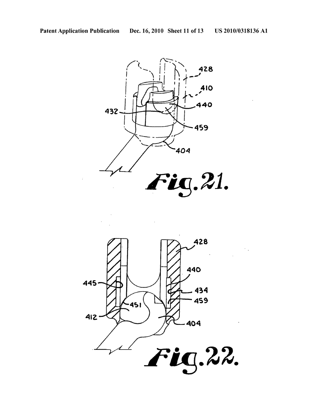 Polyaxial bone screw assembly - diagram, schematic, and image 12