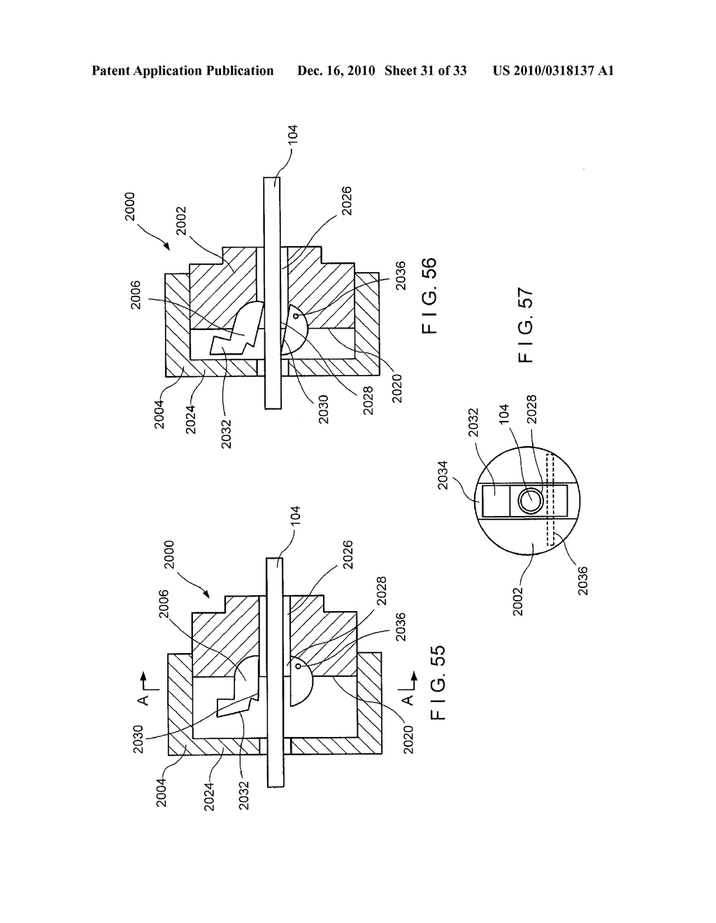 Internal Cable Fixator - diagram, schematic, and image 32