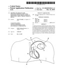 Method and apparatus for detecting imminent structural failure of an electrical lead in an implanted cardiac therapy medical device diagram and image