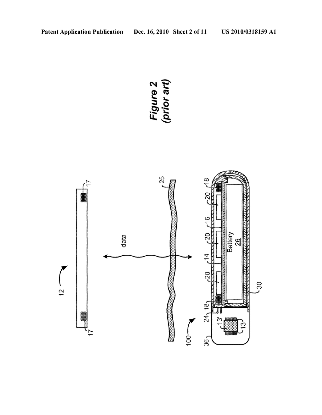 MINIATURE REMOTE CONTROLLER FOR IMPLANTABLE MEDICAL DEVICE - diagram, schematic, and image 03