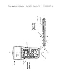 MINIATURE REMOTE CONTROLLER FOR IMPLANTABLE MEDICAL DEVICE diagram and image