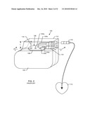 MULTIPLEXER FOR SELECTION OF AN MRI COMPATIBLE BANDSTOP FILTER PLACED IN SERIES WITH A PARTICULAR THERAPY ELECTRODE OF AN ACTIVE IMPLANTABLE MEDICAL DEVICE diagram and image