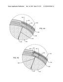 MULTIPLEXER FOR SELECTION OF AN MRI COMPATIBLE BANDSTOP FILTER PLACED IN SERIES WITH A PARTICULAR THERAPY ELECTRODE OF AN ACTIVE IMPLANTABLE MEDICAL DEVICE diagram and image