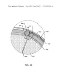 MULTIPLEXER FOR SELECTION OF AN MRI COMPATIBLE BANDSTOP FILTER PLACED IN SERIES WITH A PARTICULAR THERAPY ELECTRODE OF AN ACTIVE IMPLANTABLE MEDICAL DEVICE diagram and image