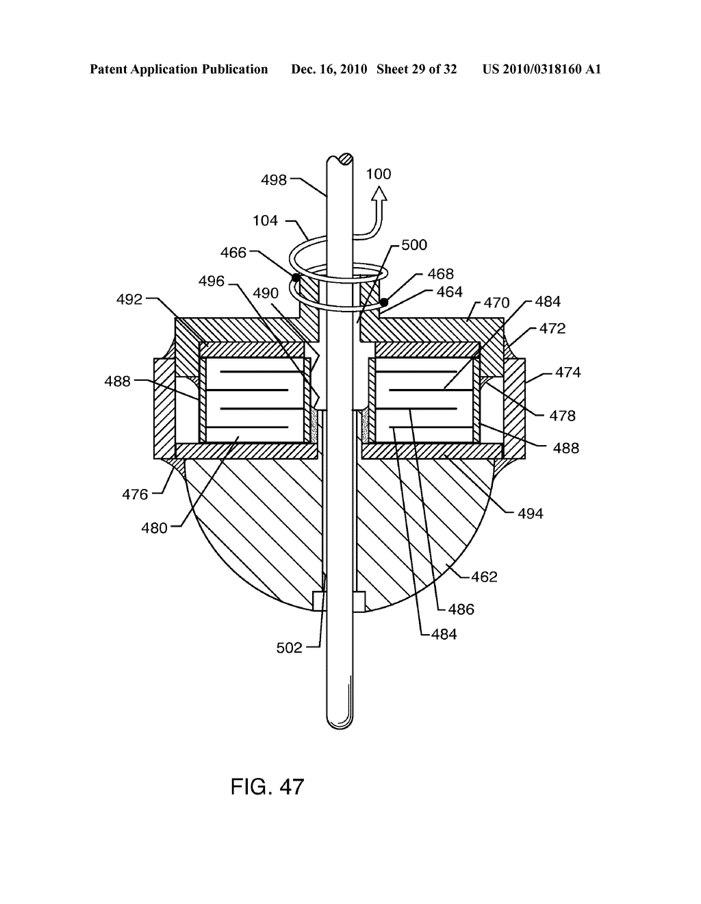 MULTIPLEXER FOR SELECTION OF AN MRI COMPATIBLE BANDSTOP FILTER PLACED IN SERIES WITH A PARTICULAR THERAPY ELECTRODE OF AN ACTIVE IMPLANTABLE MEDICAL DEVICE - diagram, schematic, and image 30