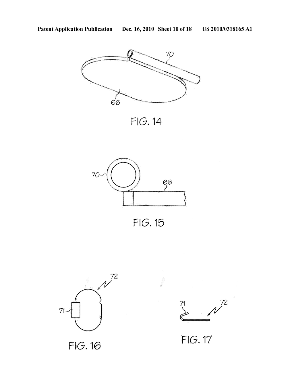 MEDICAL LEAD AND METHOD - diagram, schematic, and image 11