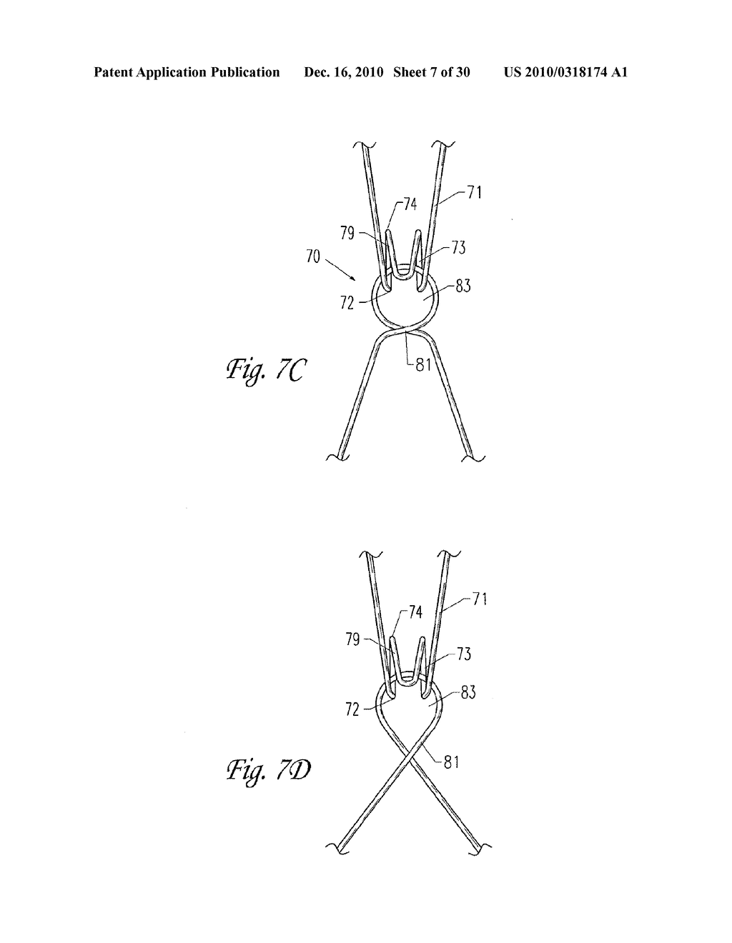 IMPLANTABLE VASCULAR GRAFT - diagram, schematic, and image 08