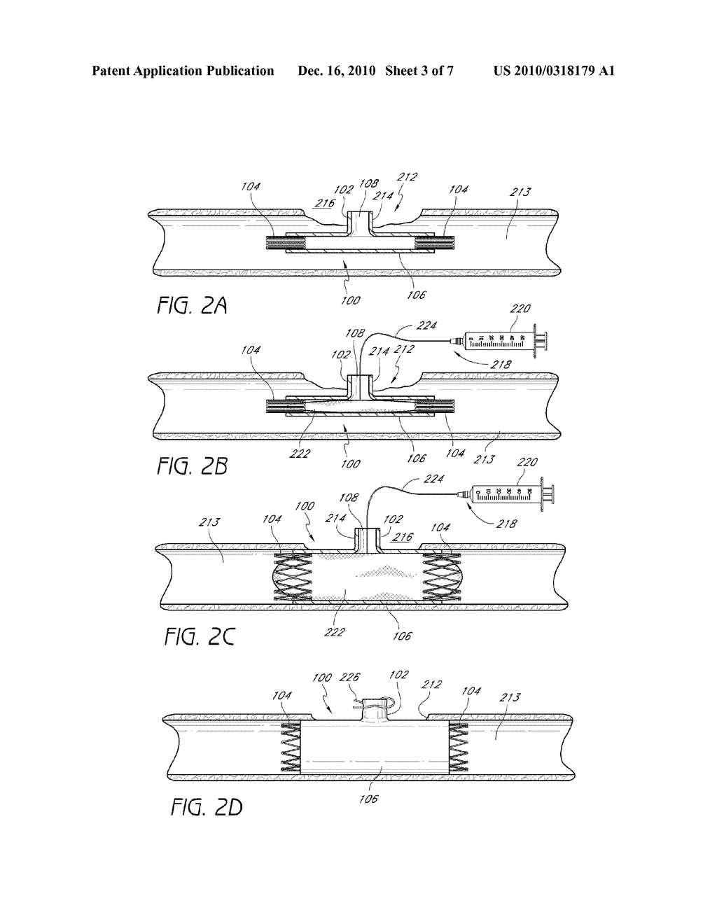 DEVICES, SYSTEMS, AND METHODS FOR REPAIR OF VASCULAR DEFECTS - diagram, schematic, and image 04