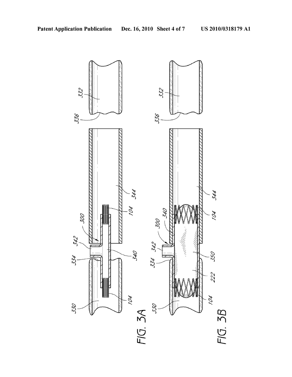 DEVICES, SYSTEMS, AND METHODS FOR REPAIR OF VASCULAR DEFECTS - diagram, schematic, and image 05