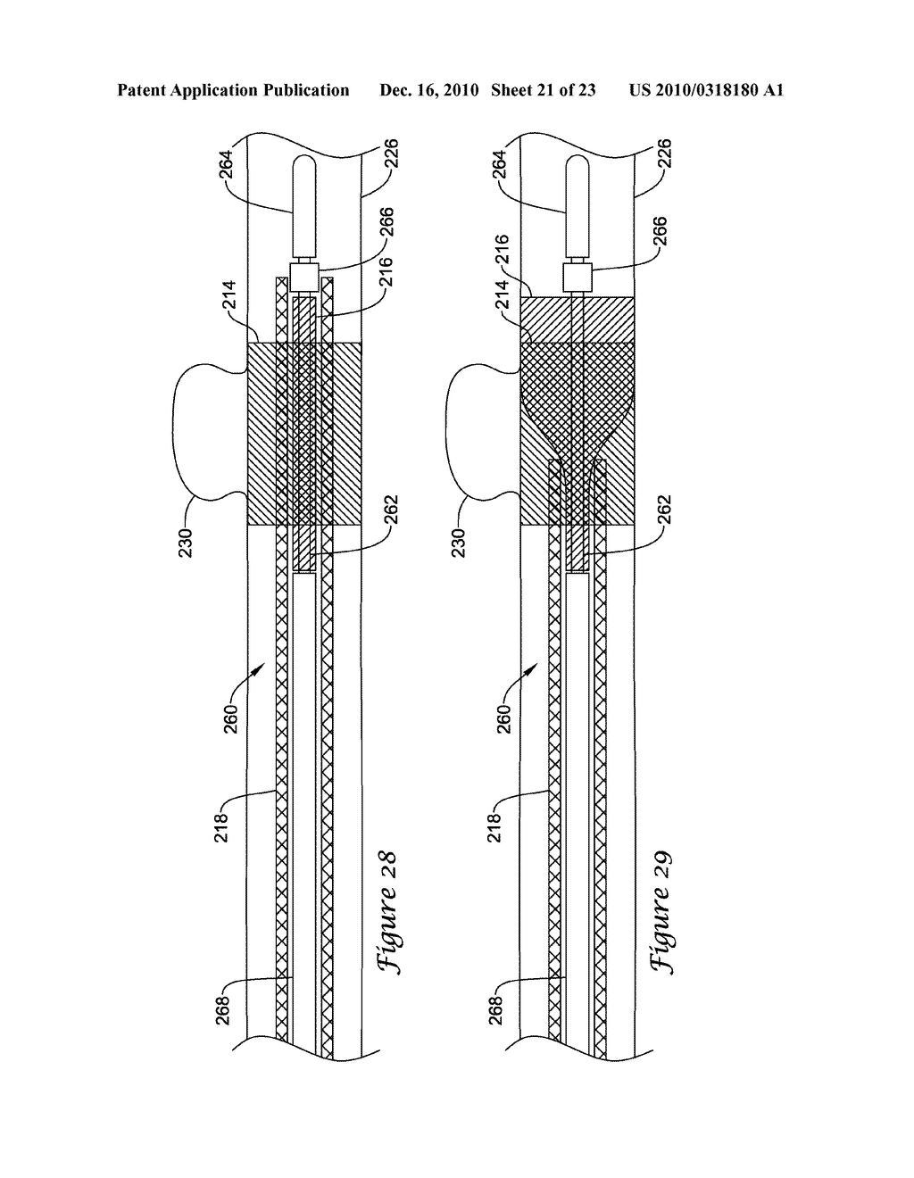 MULTI-LAYER STENT ASSEMBLY - diagram, schematic, and image 22