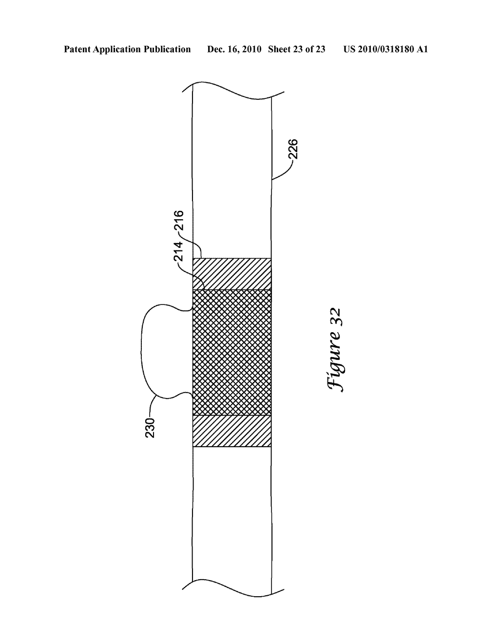 MULTI-LAYER STENT ASSEMBLY - diagram, schematic, and image 24