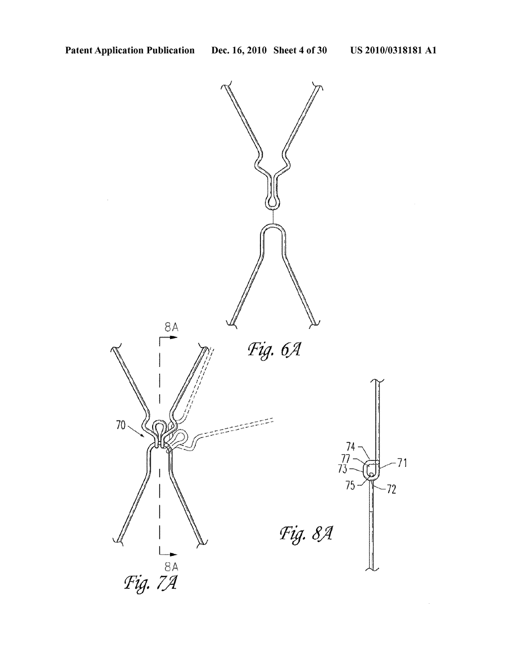 IMPLANTABLE VASCULAR GRAFT - diagram, schematic, and image 05