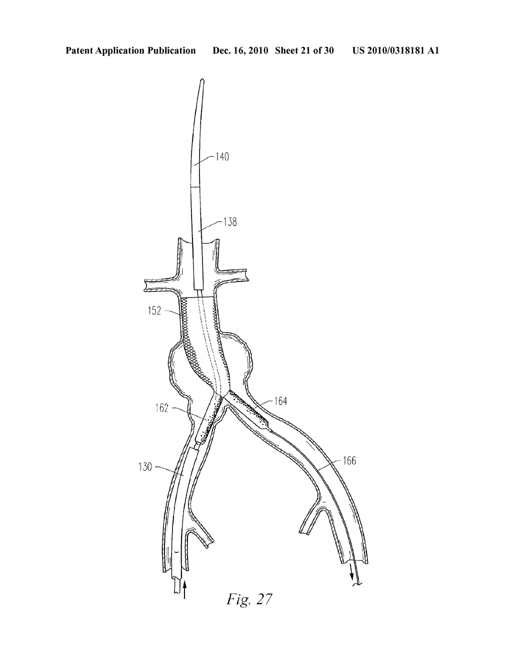 IMPLANTABLE VASCULAR GRAFT - diagram, schematic, and image 22