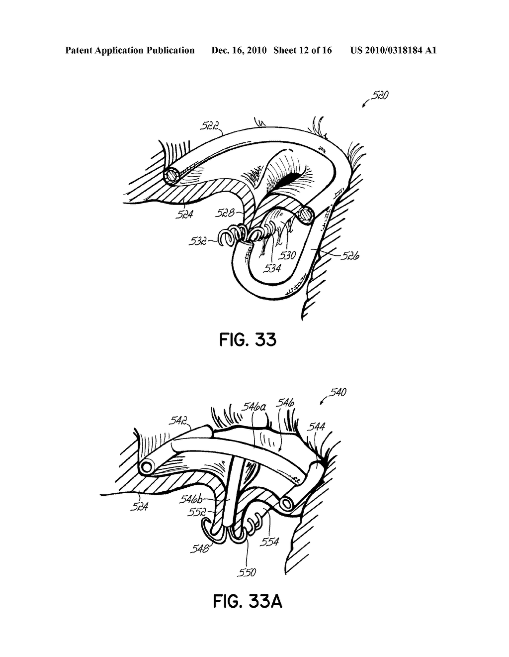 HEART VALVE REPAIR APPARATUS AND METHODS - diagram, schematic, and image 13