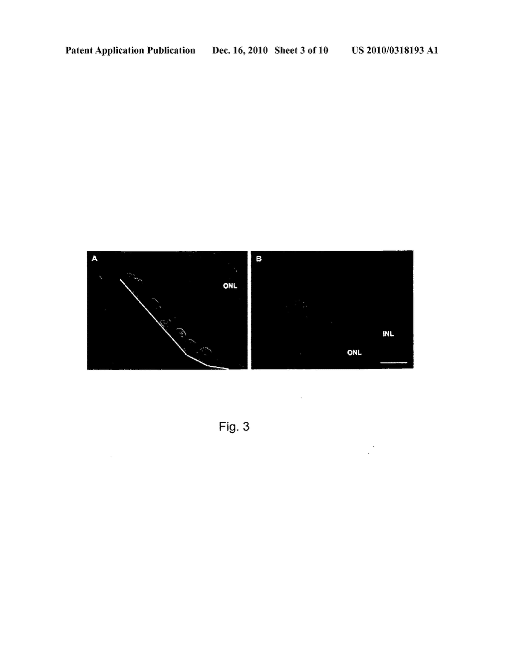 TOPOGRAPHICALLY ENGINEERED STRUCTURES AND METHODS FOR USING THE SAME IN REGENERATIVE MEDICINE APPLICATIONS - diagram, schematic, and image 04