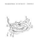 TURBOCHARGER WITH TWO-STAGE COMPRESSOR, INCLUDING A TWIN-WHEEL PARALLEL-FLOW FIRST STAGE diagram and image