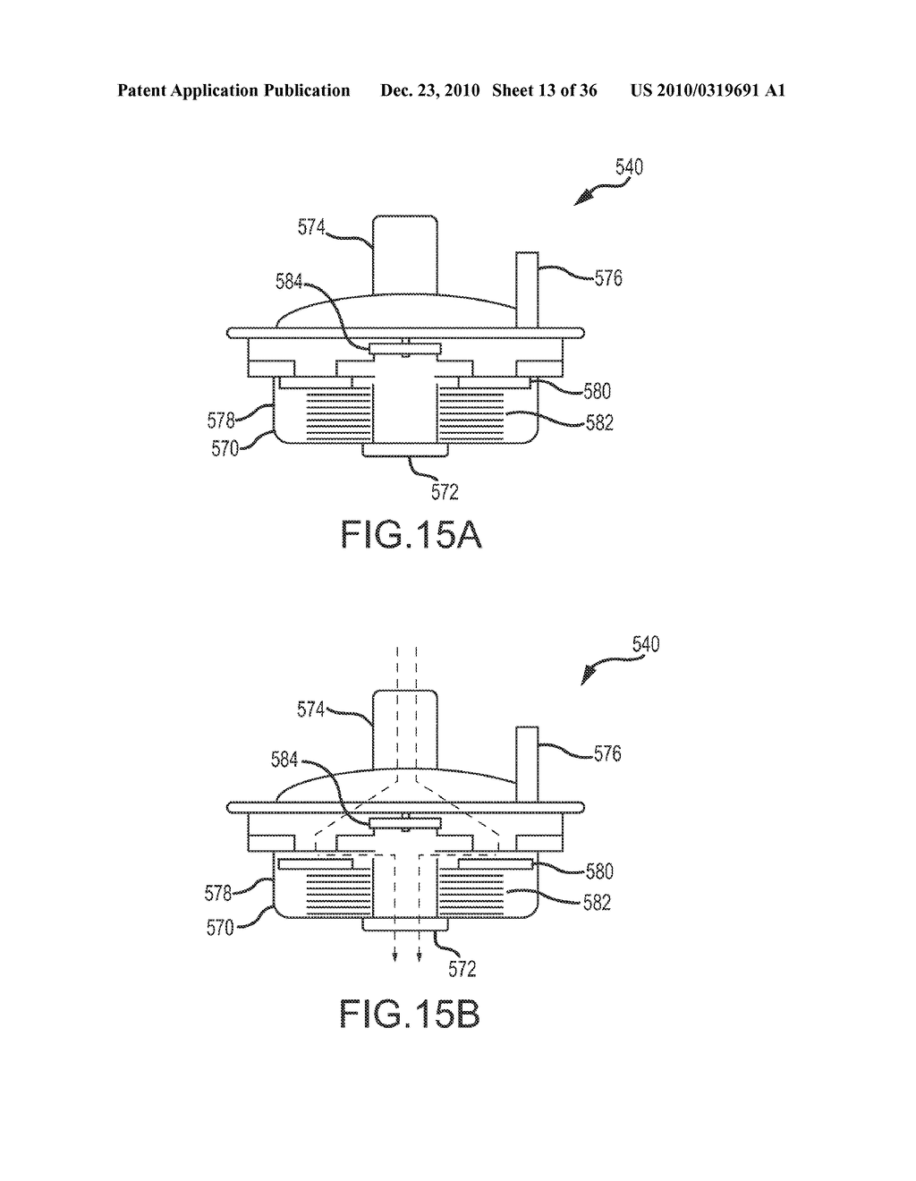 VACUUM AND POSITIVE PRESSURE VENTILATION SYSTEMS AND METHODS FOR INTRATHORACIC PRESSURE REGULATION - diagram, schematic, and image 14