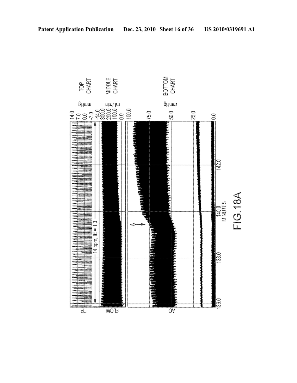 VACUUM AND POSITIVE PRESSURE VENTILATION SYSTEMS AND METHODS FOR INTRATHORACIC PRESSURE REGULATION - diagram, schematic, and image 17