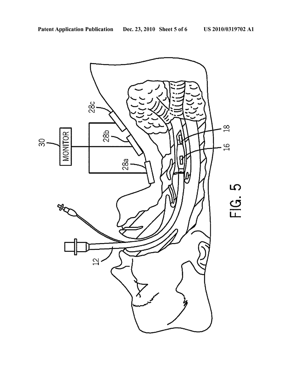 METHOD AND SYSTEM FOR DETERMINING TRACHEAL AND LOCATION INFORMATION FOR A TRACHEAL TUBE - diagram, schematic, and image 06