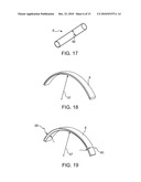 AIRWAY IMPLANT AND METHODS OF MAKING AND USING diagram and image