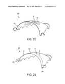 AIRWAY IMPLANT AND METHODS OF MAKING AND USING diagram and image