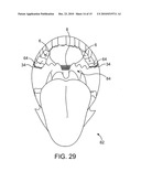 AIRWAY IMPLANT AND METHODS OF MAKING AND USING diagram and image