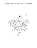 Movement Limiting Anti-Vibration Mount diagram and image