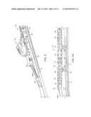 Ski With Suspension diagram and image