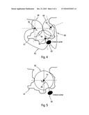 MAST-MOUNTED SONAR diagram and image