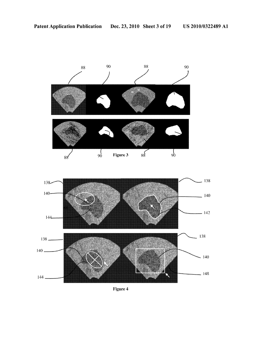 SYSTEM AND METHOD FOR IMAGE SEGMENTATION - diagram, schematic, and image 04