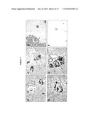 NEW PLASMA MEMBRANE BIOMARKERS PREFERENTIALLY EXPRESSED IN PANCREATIC BETA CELLS USEFUL IN IMAGING OR TARGETING BETA CELLS diagram and image