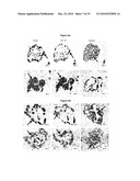 NEW PLASMA MEMBRANE BIOMARKERS PREFERENTIALLY EXPRESSED IN PANCREATIC BETA CELLS USEFUL IN IMAGING OR TARGETING BETA CELLS diagram and image