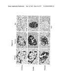 NEW PLASMA MEMBRANE BIOMARKERS PREFERENTIALLY EXPRESSED IN PANCREATIC BETA CELLS USEFUL IN IMAGING OR TARGETING BETA CELLS diagram and image